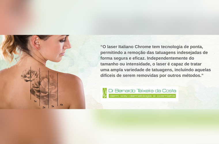 Laser Italiano Chrome: Um potente aliado na remoção de tatuagem indesejada 